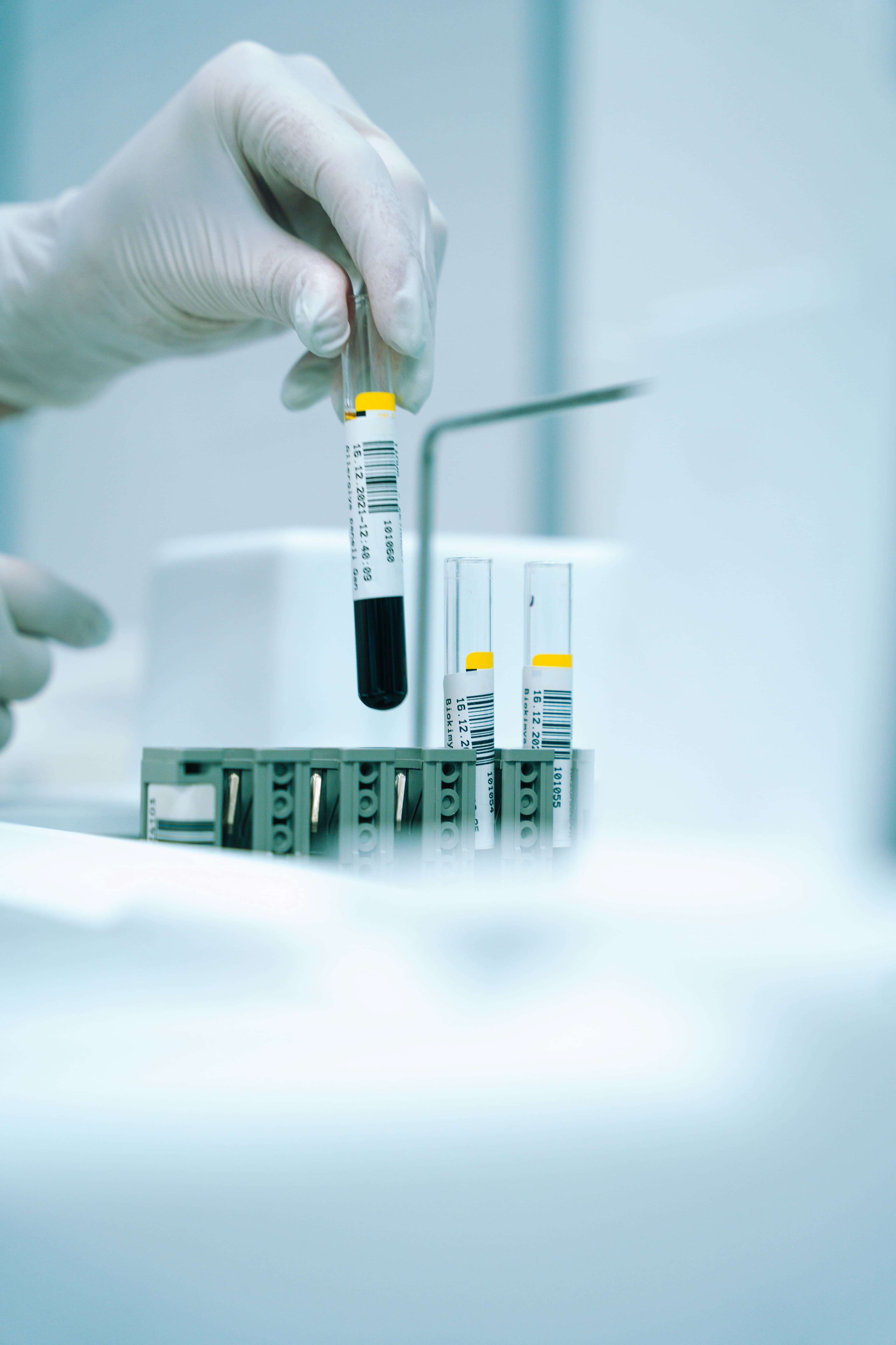 Niska ferrytyna przy prawidłowej hemoglobinie – co oznacza?